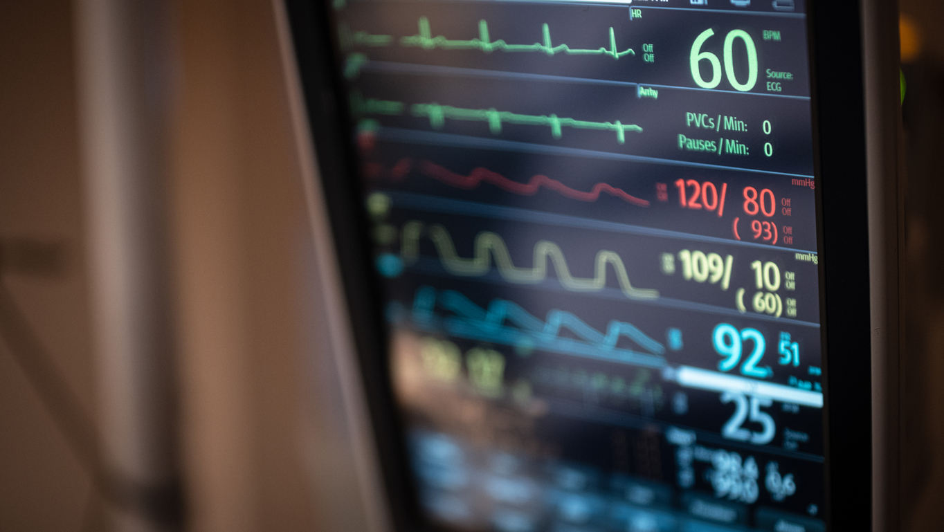 A patient's vital signs are displayed on a bedside monitor.